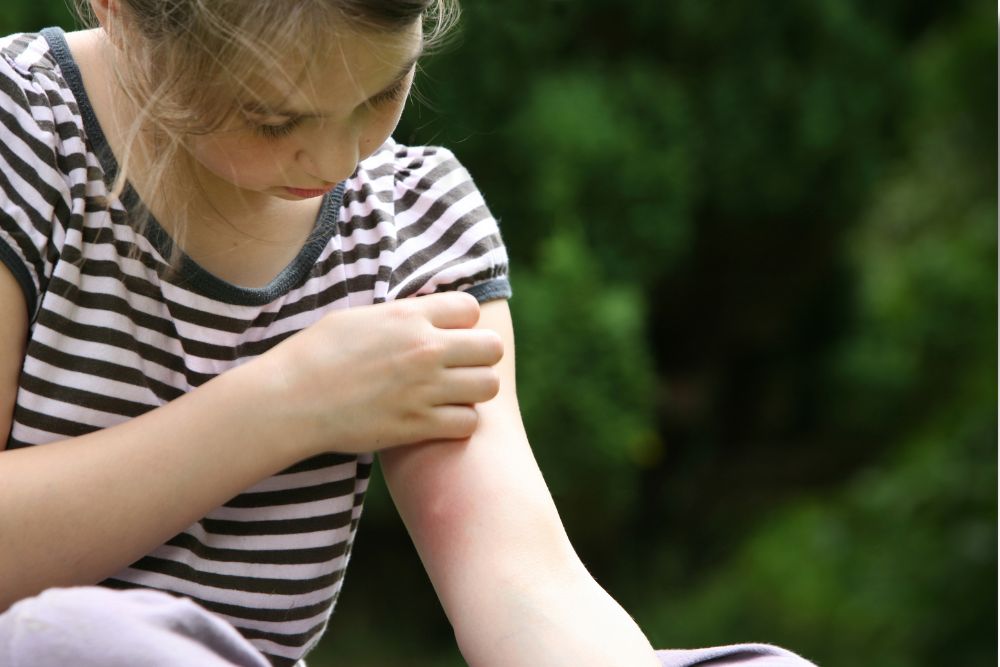 Alergia a Insetos em Blumenau