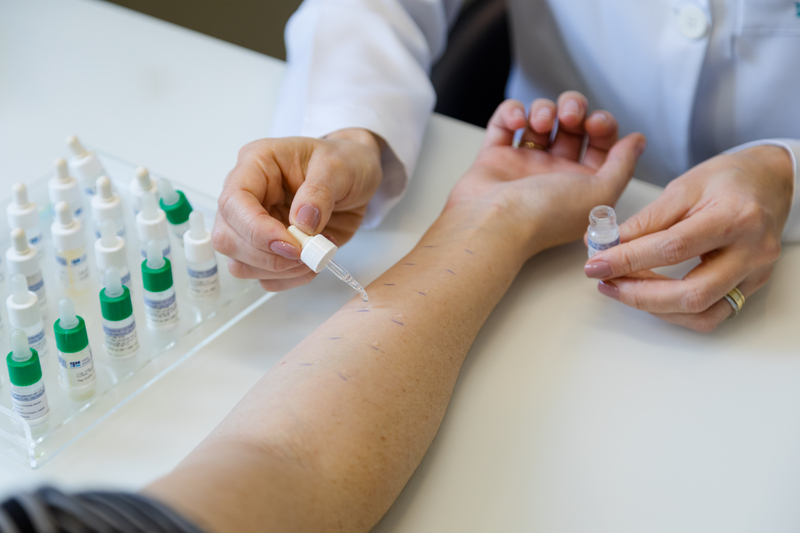 Teste Cutâneo Alérgico (Prick Test) em Blumenau - Dra. Soraya Monari