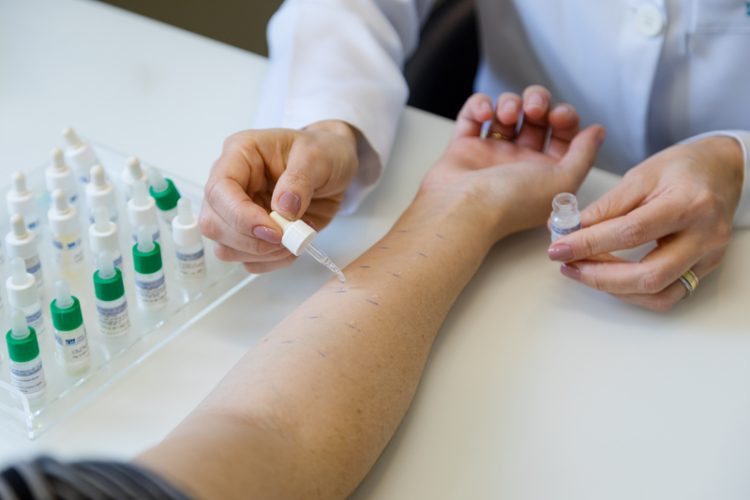 Teste Cutâneo Alérgico (Prick Test) em Blumenau - Dra. Soraya Monari